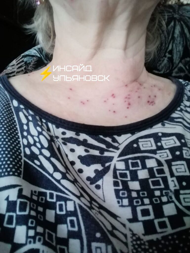 Жители Сурского района страдают от нашествия мошек